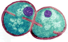 elctron micrograph of Deinococcus radiodurans  (Battista)